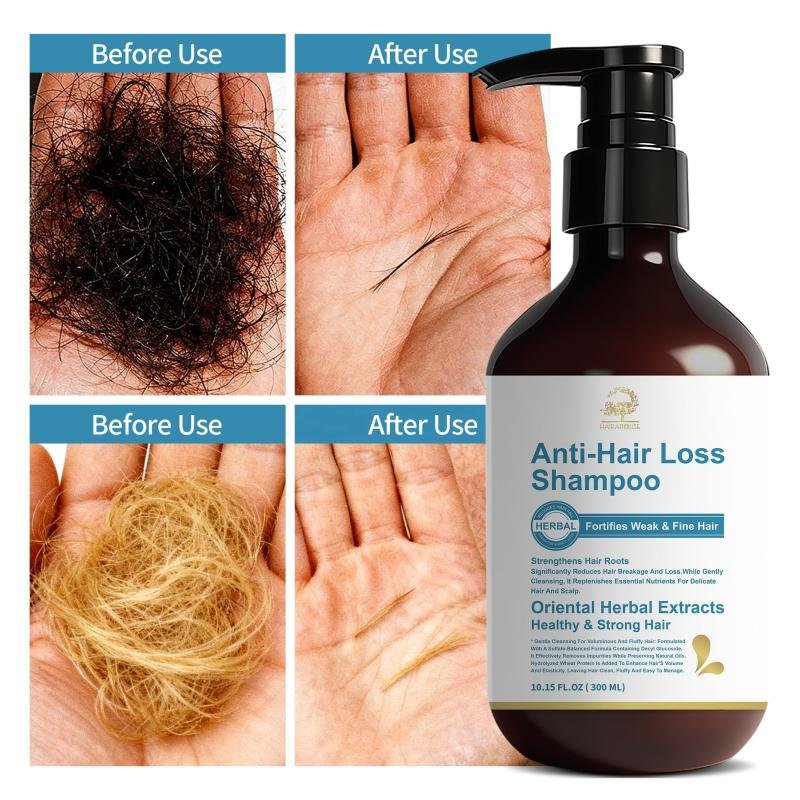 Organic 300Ml Anti Hair Loss Shampoo for Fortifies Weak and Fine Hair Improve Healthy Scalp and Strong Hair Roots